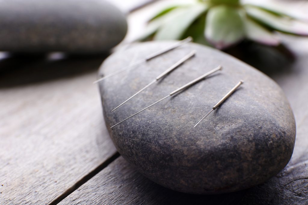 Losing Weight Through Acupuncture